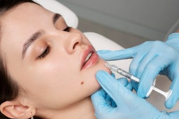 Endolift for Knee Laxity: Thigh & Knee Contouring