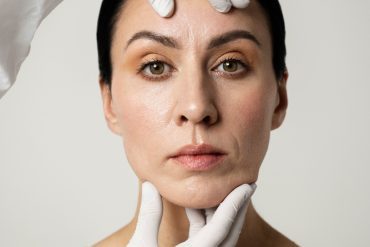 Sculpting the Neck With Endolift