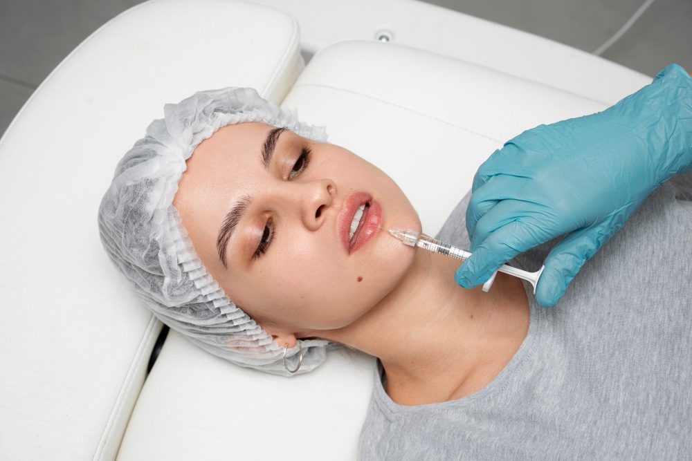 lip filler1