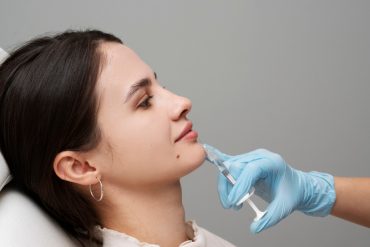 Single Session, Dramatic Chin Results: Endolift Testimonial